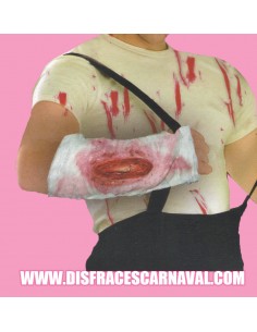 Venda hueso fracturado